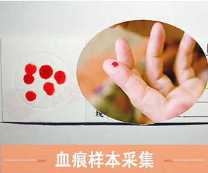 血痕样本采集