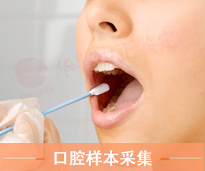 口腔拭子采集